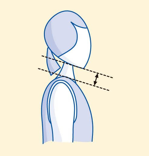 Collare cervicale morbido sagomato Ottobock necky 50c20 - immagine 2